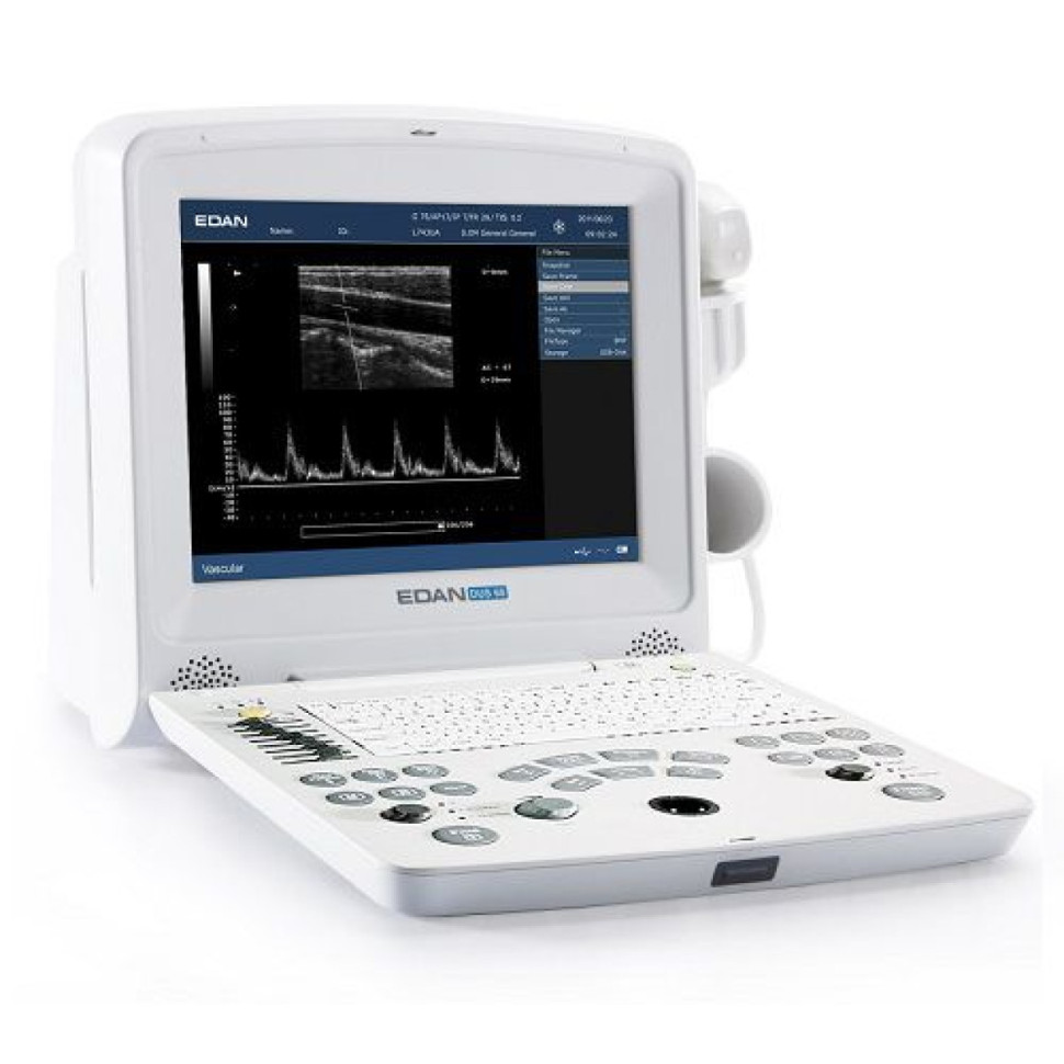 Аппарат УЗИ Edan DUS 60 (стандартный)
