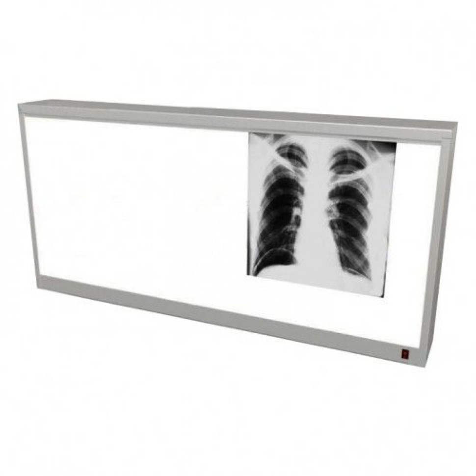 Негатоскоп 3-кадровый НОН 907-03-"МСК"