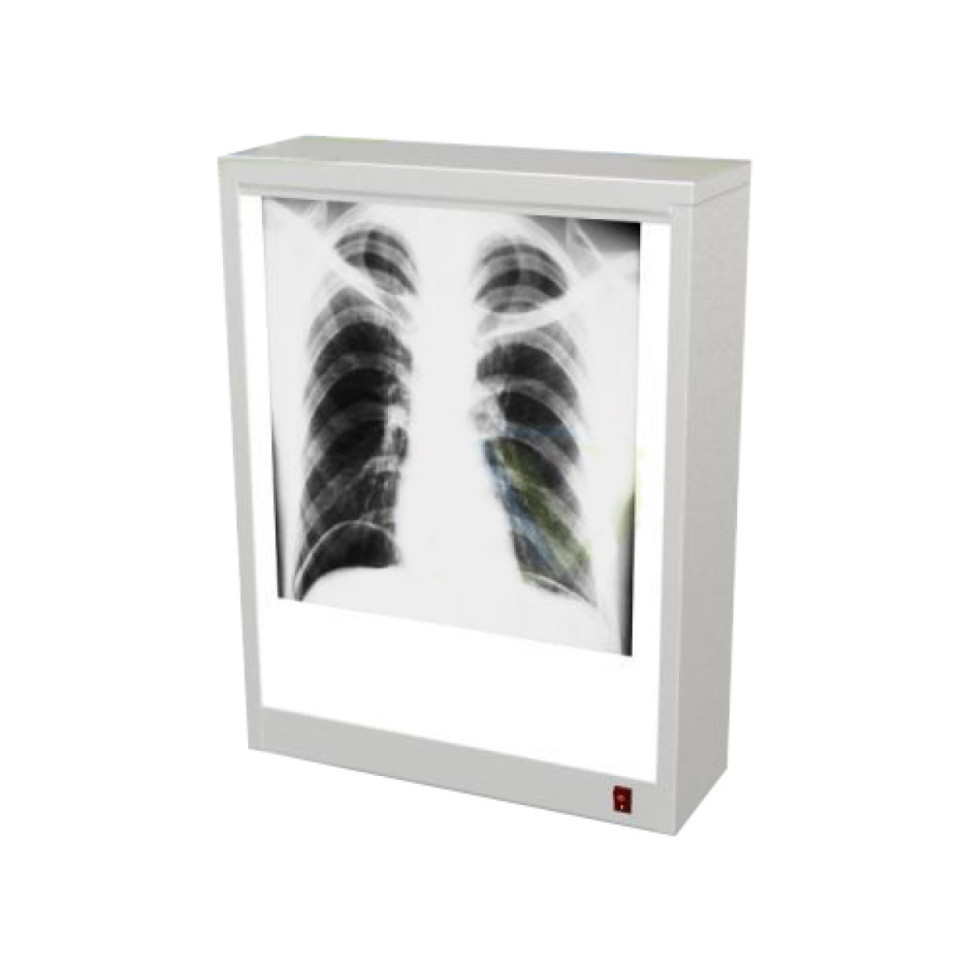 Негатоскоп 1-но кадровый НОН 907-01-"МСК"