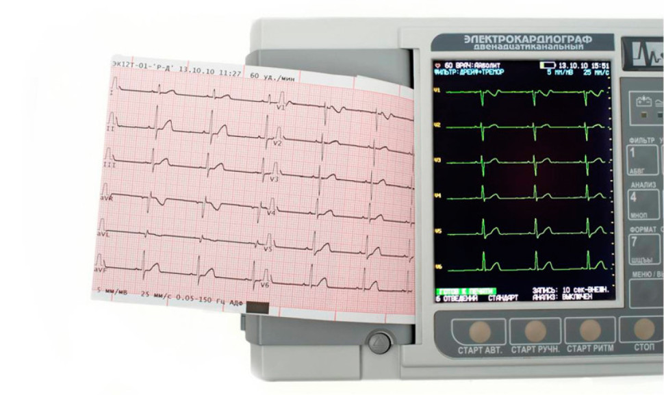 Электрокардиограф 3-6-12 канальный ЭК12Т-01-"Р-Д" (экран 141мм, G0200)