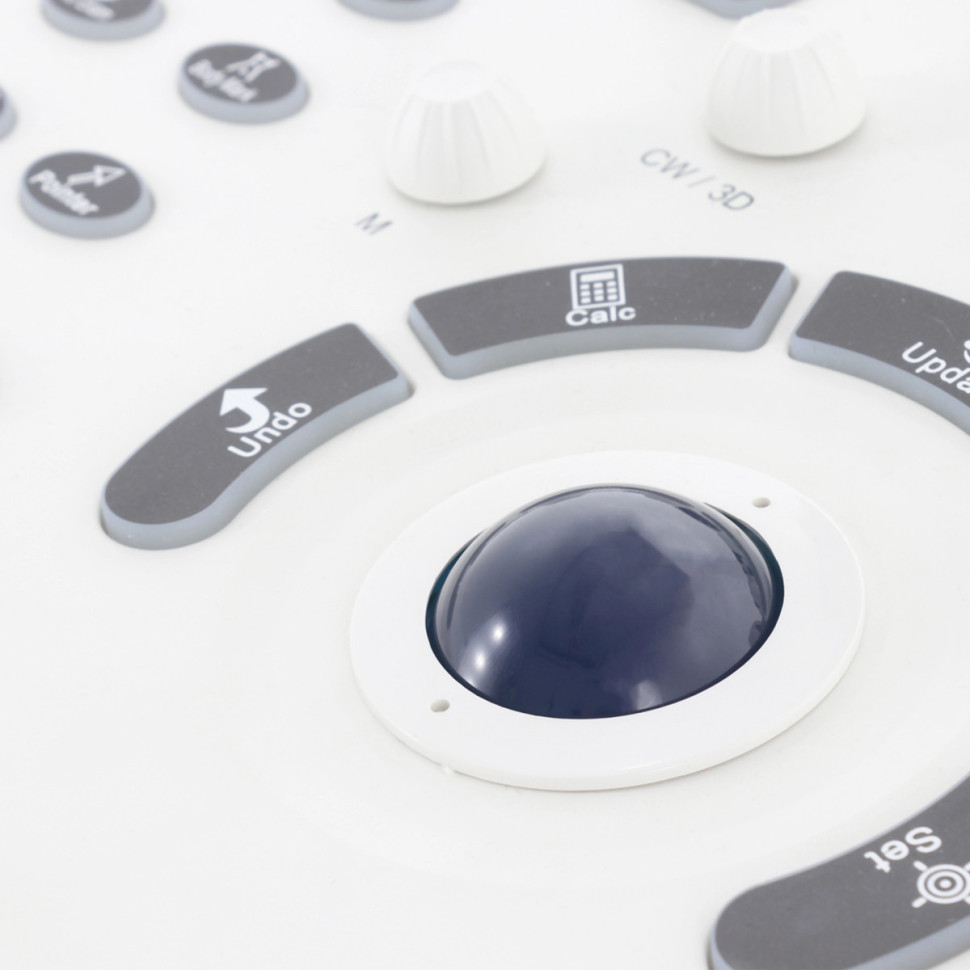 УЗИ СКАНЕР MED-MOS ЕМР3000 (2 датчика: линейный,конвексный)