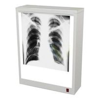 Негатоскопы